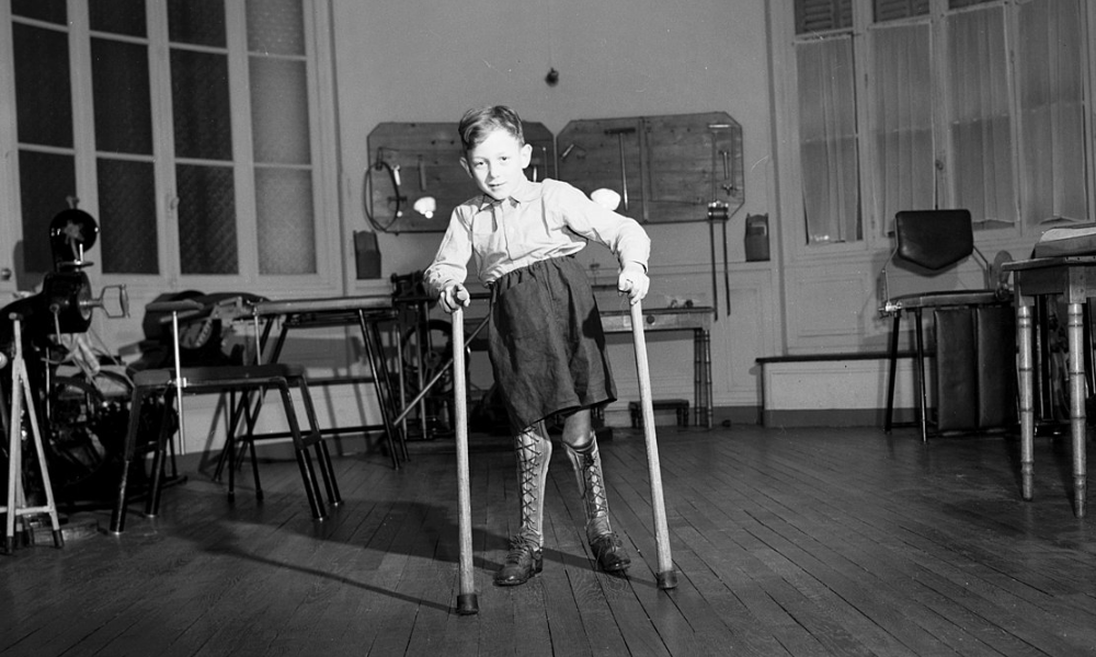 niño paralizado por el virus de la polio