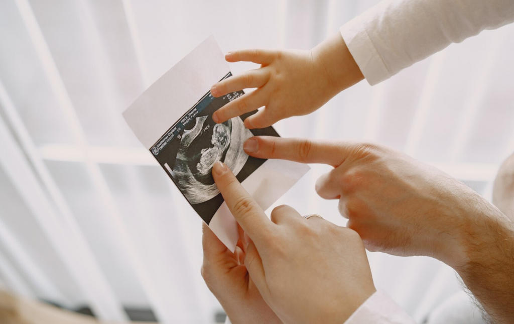 imagen ilustrativa de la tasa de natalidad: varias manos de madre padre hijo chico señalando la ecografía de un bebé en la panza
