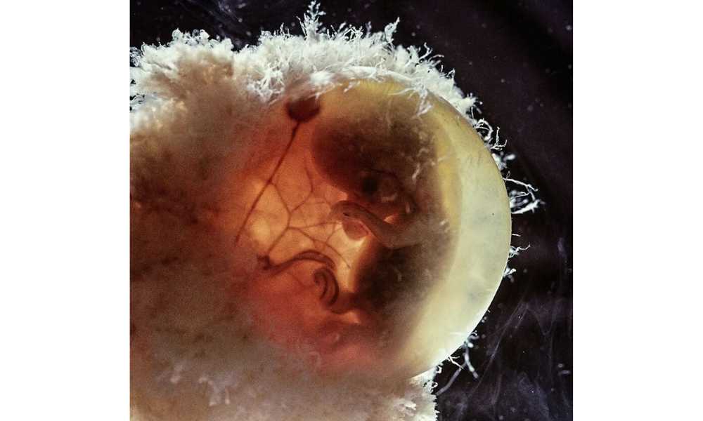 Fotos de un feto humano