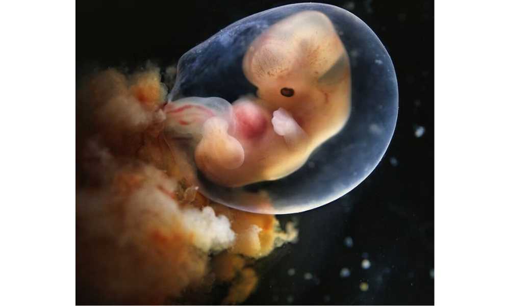 Foto adentro de un útero