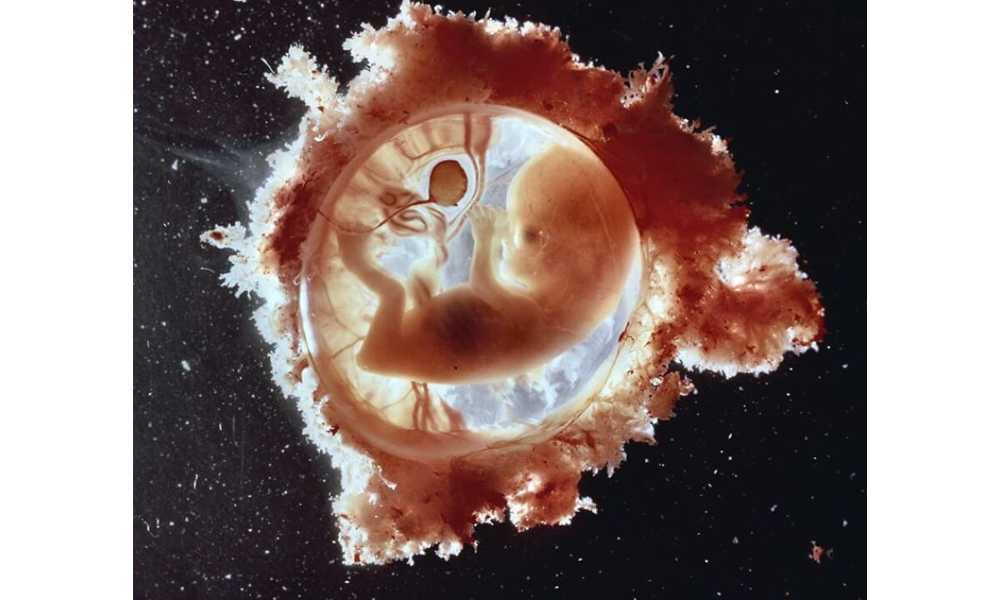 Foto de un feto humano