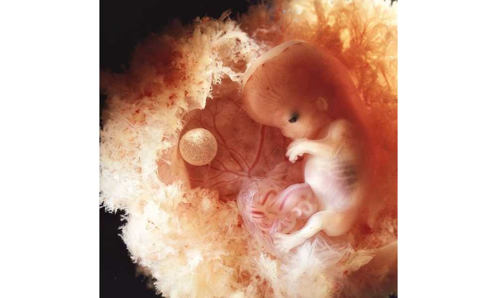 Foto dentro de un útero humano