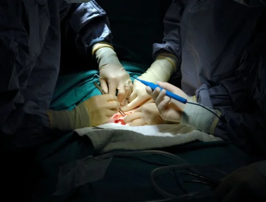 Historia de la medicina: ¿Cuándo y dónde se realizó la primera cesárea exitosa?