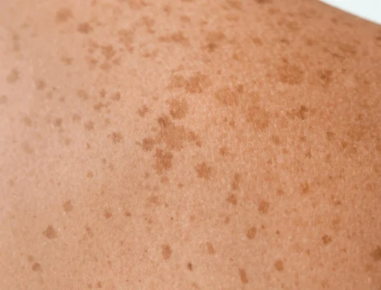 El órgano más grande del cuerpo humano no está dentro de él
