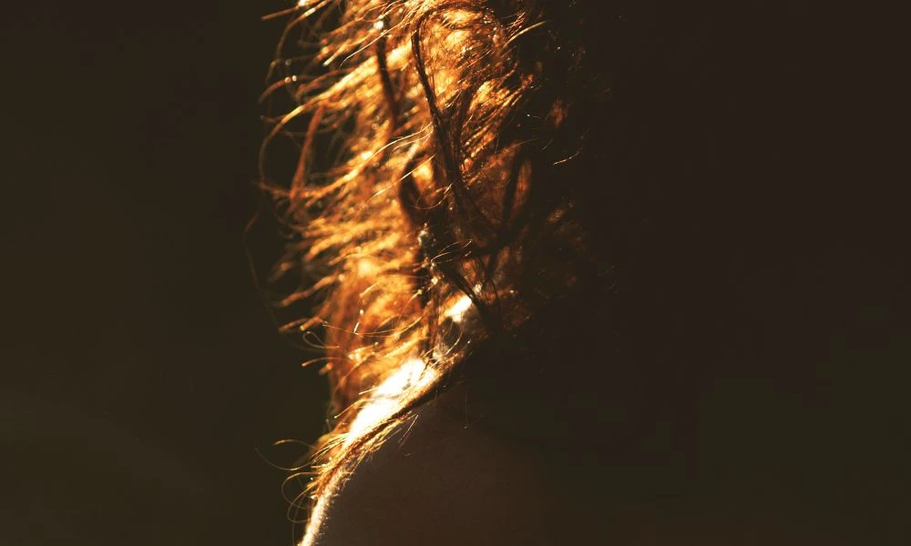 Pelo grasoso.